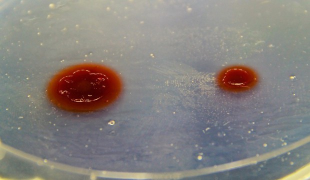 Bacteria that divide their metabolic labour (left colony) grow faster than bacterial cells that produce all amino acids on their own (right colony). Image by Samay Pande (MPI for Chemical Ecology).